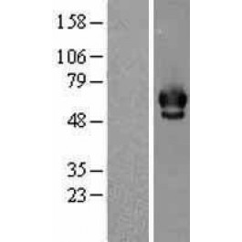NBL1-09147